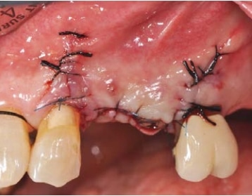 Post-surgical view