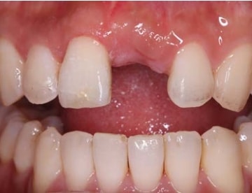 Pre-operative view
